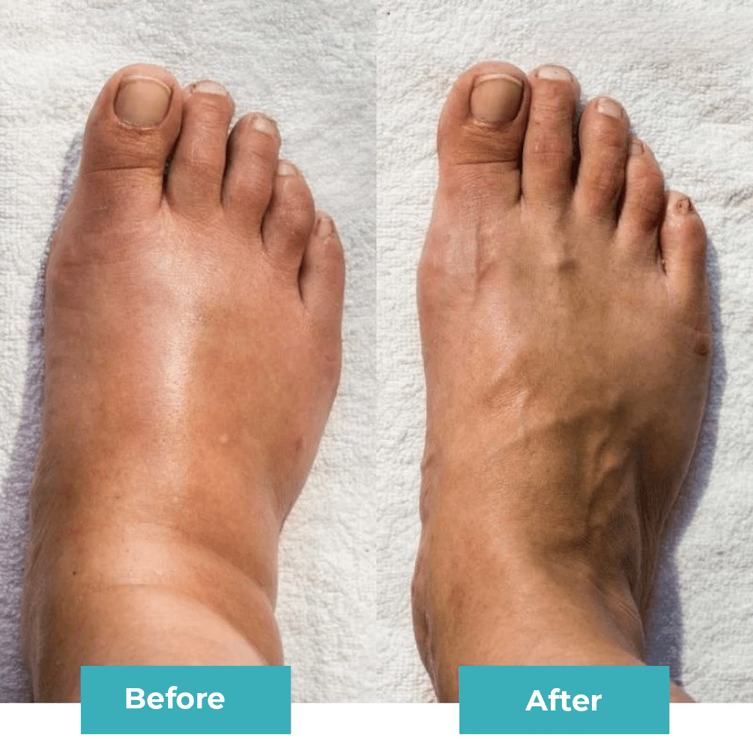 Leveas™ Relief Pulse Foot Massager - Leveas